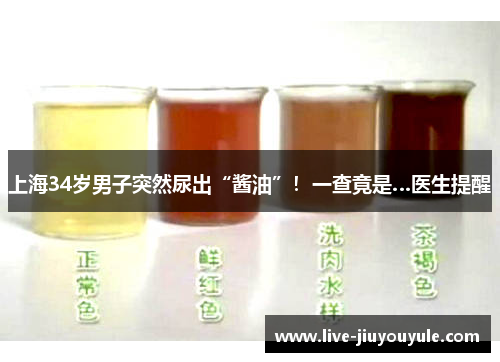 上海34岁男子突然尿出“酱油”！一查竟是…医生提醒